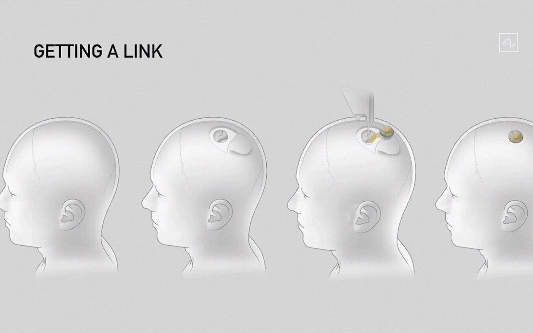 Neuralink to Begin Mass Production of Brain Implants in 2026, Musk Says